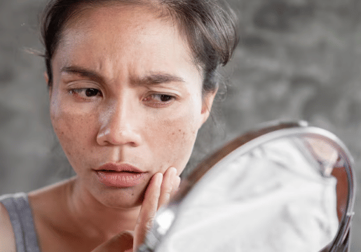 Pertanyaan tentang Kulit – 12 Jawaban Lengkap Popbela